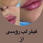 کلینیک پوست مو لیزر و لاغری عصر زیبایی