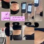کلینیک پوست مو لیزر و لاغری عصر زیبایی