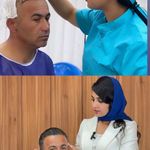 کاشت مو -کاشت ابرو -کاشت ریش شکیبا
