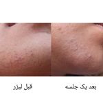 مرکز لیزر لیانا