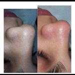 فشیال و درمان مشکلات پوستی لیندا