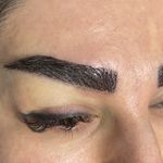 کاشت ابروی هیلدا