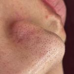خدمات فیشال، جو انسازی و مشاوره پوست