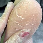 خدمات فیشال، جو انسازی و مشاوره پوست