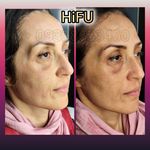 مطب پوست ،مو و لیزر یسنا طب