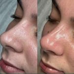 کلینیک فیشال و پاکسازی پوست نازی طلاکوب