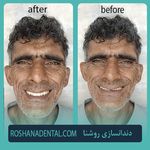 لابراتوار دندانسازی روشَنا