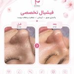 خدمات تخصصی فیشیال و ماساژ فاطمه