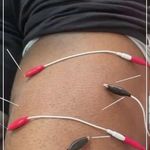 مرکز فیزیوتراپی مانا