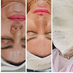 فیشال تخصصی پوست