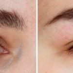 کلینیک تخصصی کاشت ابرو و مو صدف