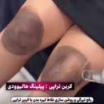 کلینیک زیبایی مهر دخت آتوسا
