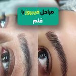 خدمات تخصصی ریمو و آرایش دائم