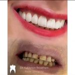 مطب دندانپزشکی دکتر کتایون رضاخانی