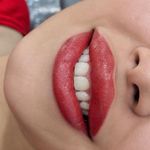 مرکز آرایش دائم وریموو وپوست گندم فلاحی