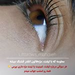 لیفت و لمینت ابرو و مژه فرزانه