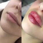 کلینیک پوست وزیبایی ومرکز تخصصی فیلربادی