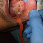 دندانپزشکی لایک دنتال