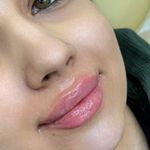 کلینیک زیبایی، پوست و لیزر(کندلا)  ظفر