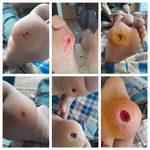 کارشناس زخم و متخصص کیوم تراپی بهرامی فر