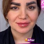 مرکز پوست و مو، زیبایی و لیزر صبا