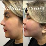 مرکز پوست و مو، زیبایی و لیزر صبا