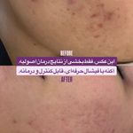 فیشال تخصصی پوست هلیا