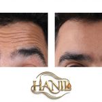 کلینیک زیبایی هانیل
