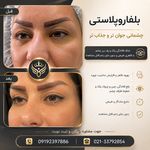 کلینیک پوست،مو،زیبایی،مرکز لیزر ‌پرنسا