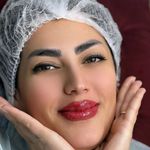 خدمات تخصصی آرایش دائم و ریموو فرشته حمیدی