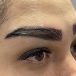 کلینیک تخصصی کاشت مو و ابروی فروهر