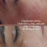 خدمات تخصصی ودرمانی با سلولهای بنیادی