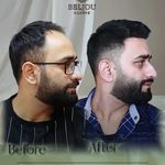 کلینیک زیبایی بلژو