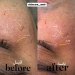 سالن تخصصی کوتاهی مو و فیشیال امیربارویی