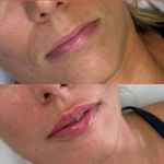 کلینیک پوست و زیبایی ژیلاوَش