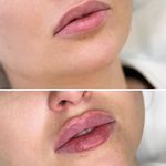 مرکز لیزر و زیبایی دمور