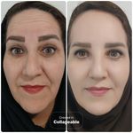 مرکز لیزر و زیبایی دمور