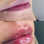 مرکز لیزر و زیبایی دمور