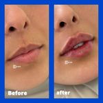 مرکز لیزر و زیبایی دمور- تخفیف 40 درصدی