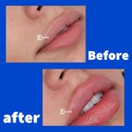 مرکز لیزر و زیبایی دمور- تخفیف 40 درصدی