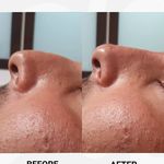 مرکز لیزر و زیبایی دمور- تخفیف 40 درصدی