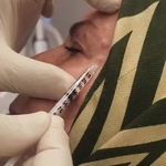 مرکز لیزر و زیبایی دمور- تخفیف 40 درصدی