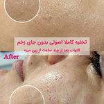 خدمات تخصصی فیشال