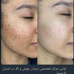 فیشال و پاکسازی پوست مرضیه صالحی