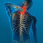 مطب تخصصی درمان ستون فقرات ( مکانیک درد)