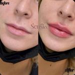 کلینیک زیبایی و مرکز لیزر سنسیا