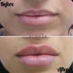 کلینیک زیبایی و مرکز لیزر سنسیا