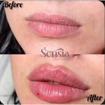 کلینیک زیبایی و مرکز لیزر سنسیا