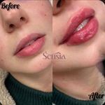 کلینیک زیبایی و مرکز لیزر سنسیا