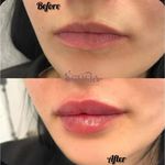 کلینیک زیبایی و مرکز لیزر سنسیا